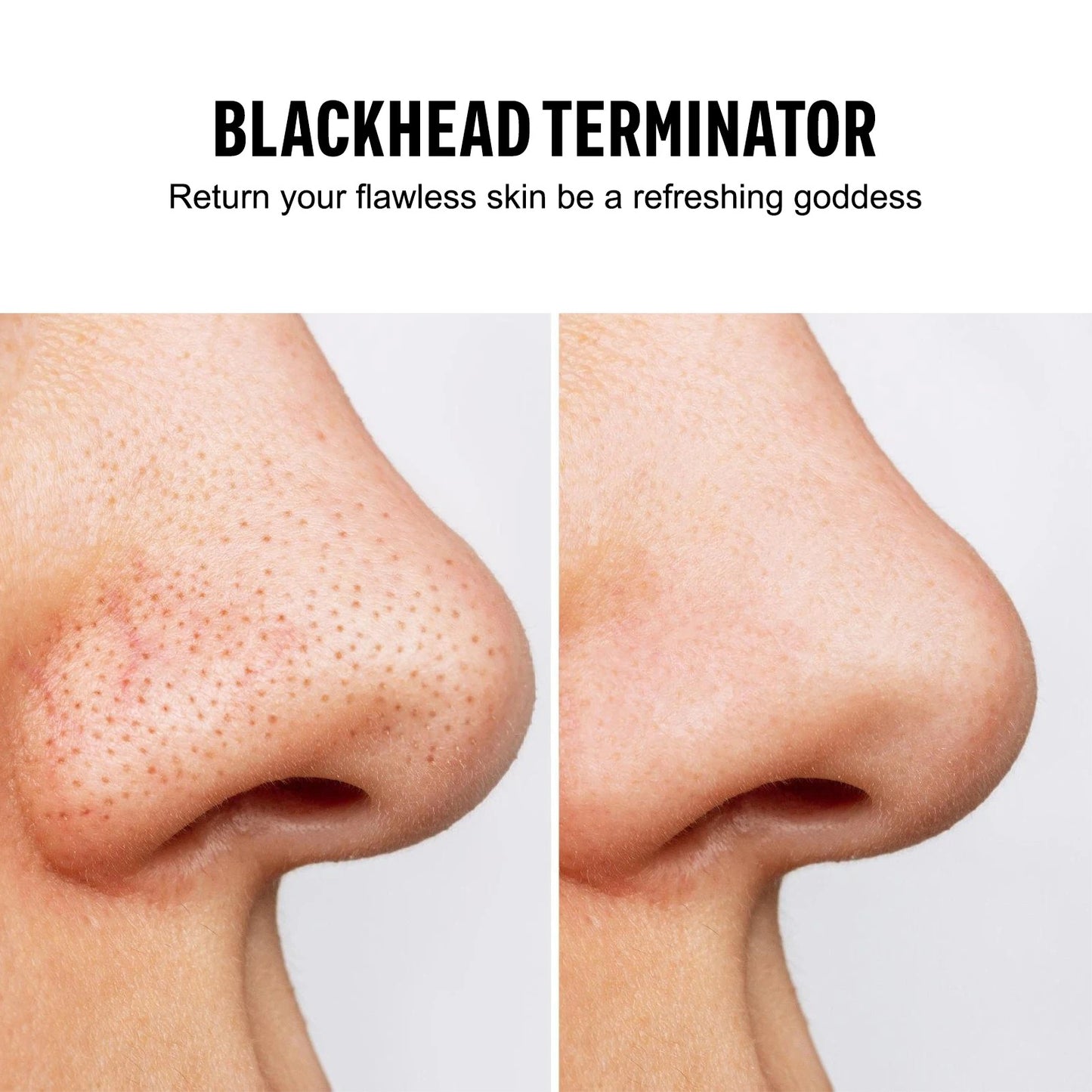 Blackhead Remover Vacuum Suction USB Rechargeable Facial Pore Cleaner Comedone Spot Acne Pimple Black Head Extractor Care Tools