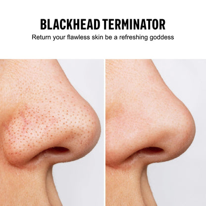 Blackhead Remover Vacuum Suction USB Rechargeable Facial Pore Cleaner Comedone Spot Acne Pimple Black Head Extractor Care Tools