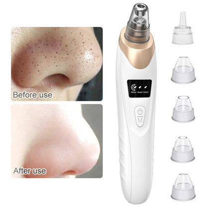 Blackhead Remover Vacuum Suction USB Rechargeable Facial Pore Cleaner Comedone Spot Acne Pimple Black Head Extractor Care Tools